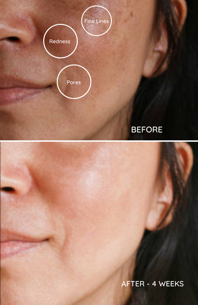 Load image into Gallery viewer, Rani - Soft Glow Face Serum