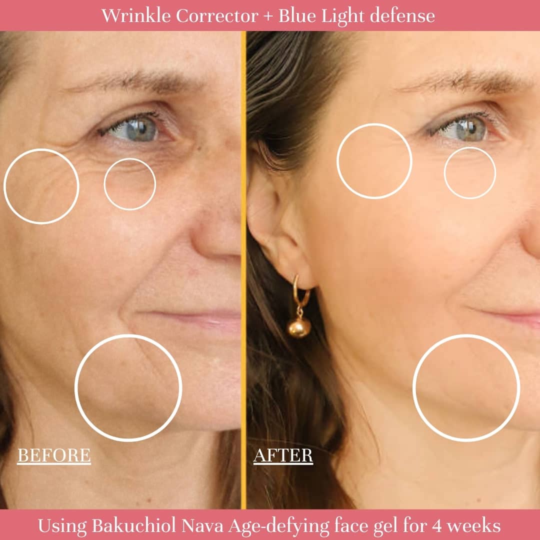 Bakuchiol Nava Age-Defying Face Gel Moisturizer – Aroha Oils